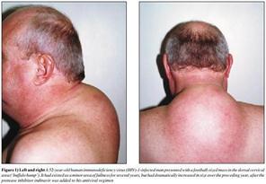http://www.virusmyth.net/aids/pics/buffalo.jpg