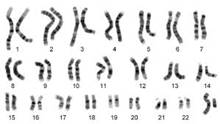 Image result for human chromosome