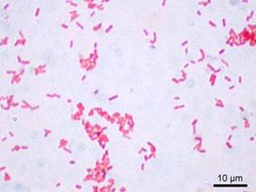 http://upload.wikimedia.org/wikipedia/commons/e/e8/Escherichia_coli_Gram.jpg