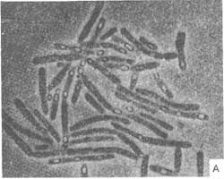 http://www.microbiologyprocedure.com/soil-microorganisms/images/phase-contrast-photomicrograph-showing-bacillus-megaterium.jpg