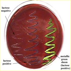 e coli on EMB.jpg